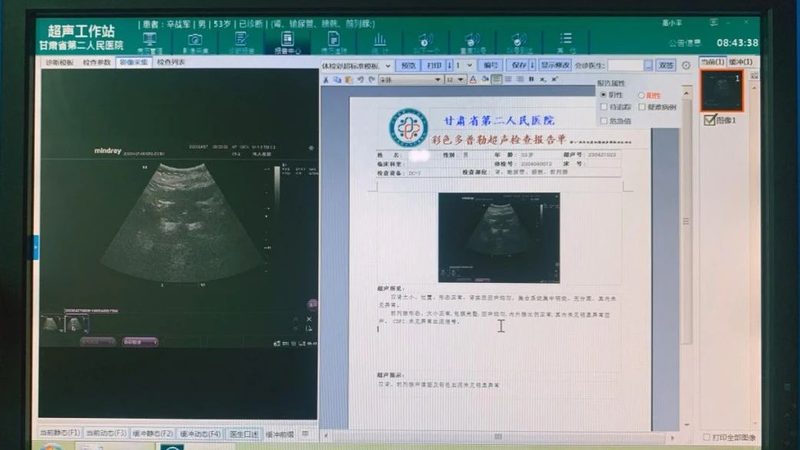 入职体检，这些项目标准你了解吗？**